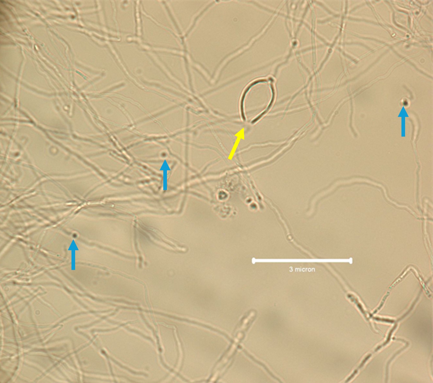 Lemon-shaped sporangium (pointed with yellow) of Phytophthora shown post-zoospore (some highlighted in blue) release.
